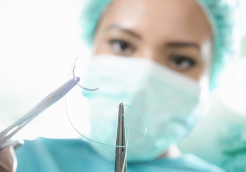 How Long Do Dissolvable Stitches Last and Why It Varies by Procedure