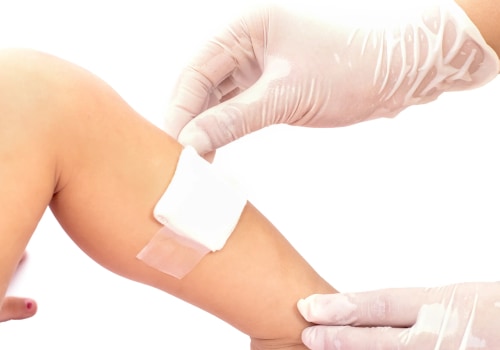 Adaptic Dressing for Burns & Wounds: Is It the Best Option?